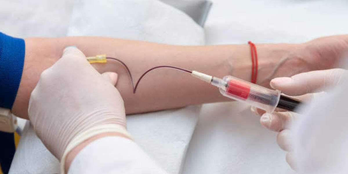 Blood Collection Market by Trends, Dynamic Innovation in Technology and 2030 Forecast, Opportunities, and Challenges, Tr